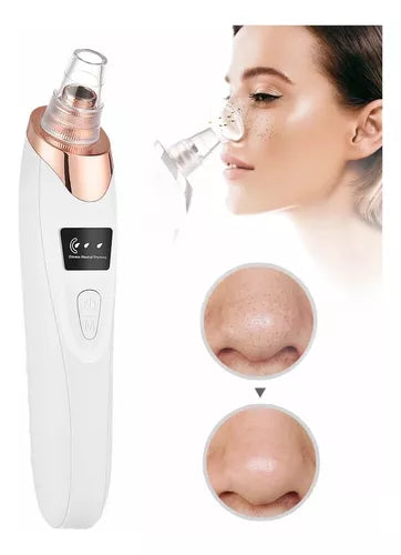 Extractor de Puntos Negros e Impurezas Recargable