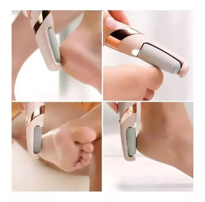 Removedor de Callos Recargable